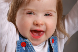 Scientists have made a breakthrough for Down's Syndrome - but warn it could be a while before there's gene therapy for the disease. Photo / AP
