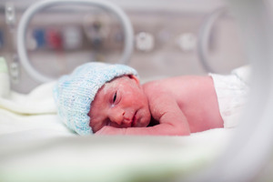 Experts have challenged a suggestion that eye drops could be linked to bowel disease in pre-term infants. Photo / Getty Images