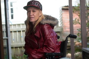 Ana Eriepa at home in Rotorua. She will soon be fitted with a prosthetic for her missing foot. Photo / Doug Sherring
