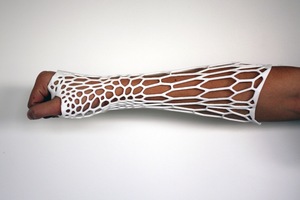 Jake Evill, from Nelson, designed the Cortex - a completely breathable, waterproof and lightweight cast for broken limbs.