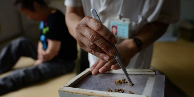 A doctor of traditional Chinese medicine prepares to administer a bee sting to a patient. Photo / AFP