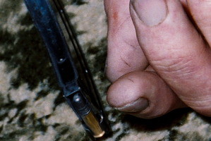 An evidence picture of Robin Bain hand which shows marks on his thumb.