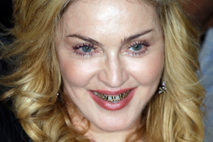 Madonna sporting a gold grill. Photo / AP