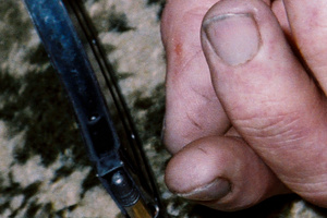 An evidence photo of Robin Bain's hand showing marks on his thumb which the TV3 documentary said came from loading the rifle.