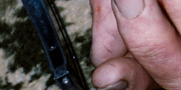 An evidence photo of Robin Bain's hand showing marks on his thumb which the TV3 documentary said came from loading the rifle.