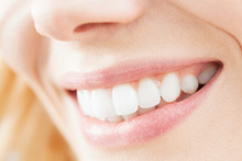 Photo / Thinkstock