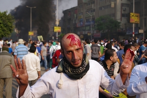 A bloodied protester after an attack during a Cairo rally.