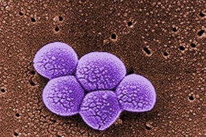 Getting rid of an antibiotic-resistant superbug, caught while in hospital care, can be worse than recovering from an operation.