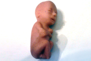 Young boys were seen running around with plastic foetuses.