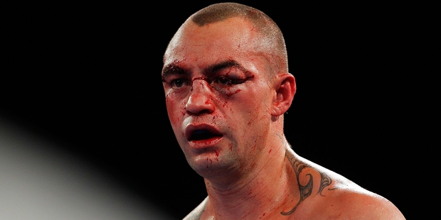 When Daniel MacKinnon regained consciousness he asked about his family, said his manager. Photo / Getty Images
