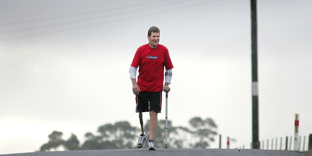 Marc Fenton was awarded $65,000 after he lost his leg in work accident at a sawmill.