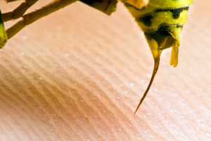 File photo / Thinkstock