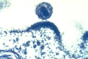 This microscopic image shows a HIV virus budding out of a human immune cell.