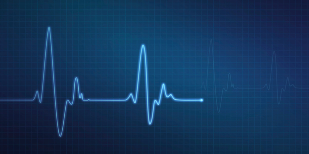 Other types of artificial heart have been constructed and fitted, with varying degrees of success. Photo / Thinkstock
