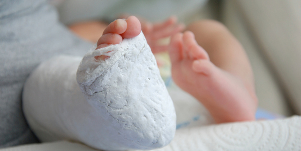 Last year 13,144 ACC injury claims were lodged for Northland kids aged 0-14, costing taxpayers $2,456,888.