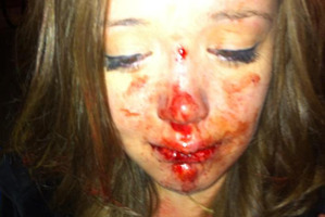 Ella Mere Eketone, shortly after allegedly being pushed to the ground. Photo . Before It's News website