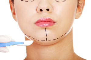 Oscar goodie bags include a $5000 facelift voucher.Photo / Thinkstock