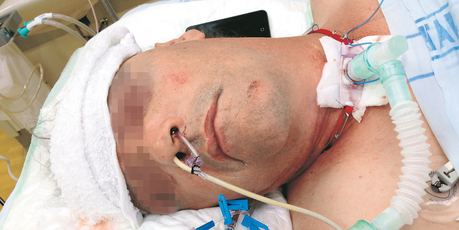 Mike's injuries were more like those of a car crash victim, doctors said. Photo / Supplied