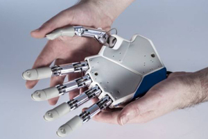 The hand will be attached directly to the patient's nervous system via electrodes. Photo / Independent