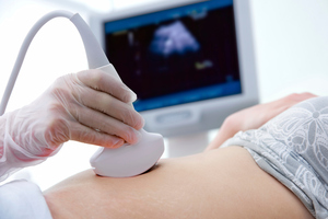 The top-up is expected to allow about 500 extra patients a month to have a scan. Photo / Thinkstock