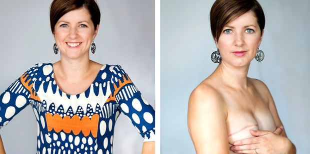 Kylie Richardson was diagnosed with breast cancer at 27. Photo / Martin Hunter