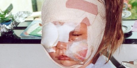Carolina Anderson after surgery.