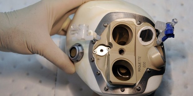 The artificial heart would be considered a success if it lasted at least a month in all four participants.
Photo / AFP
