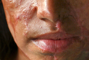 An Iranian man has been sentenced to having his eyes gouged out for throwing acid over a girl's face. Photo / Thinkstock