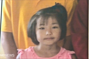 Sakurako Uehara from Japan is the latest victim of a dog attack. Photo / TVNZ
