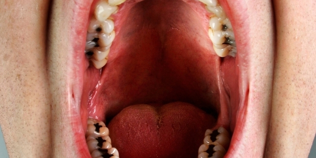 Mercury is officially considered a dangerous metal ... in any place other than our mouths, that is. Photo / APN