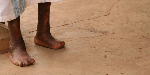 Suitable care is not available in the public or private health system in Chittagong. Photo / Thinkstock