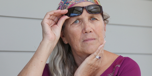 Being unable to blink is painful and life-disrupting for Linda Cole. Photo / Rhys Palmer