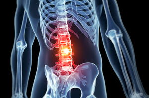 Photo / Thinkstock