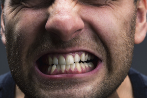 Teeth-grinding is becoming more common. Photo / Thinkstock