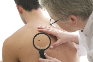 People suffering from itchy eczema may have less risk of skin cancer, according to new research.
Photo / Thinkstock