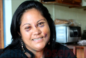 Lemalu Sina Retzlaff spoke out about the alleged assault last month. Photo / Samoa Observer