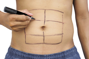 Photo / Thinkstock