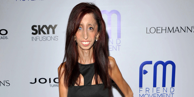 Author and motivational speaker Lizzie Velasquez. Photo / AP
