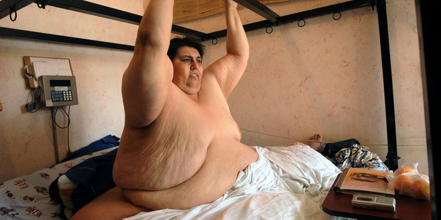 At his heaviest, Manuel "Meme" Uribe Garza weighed 559kg. Photo / AP