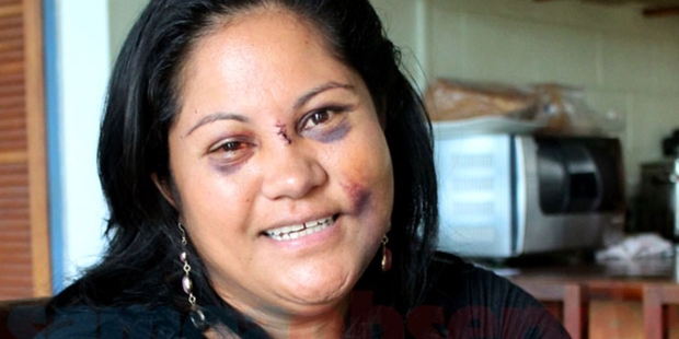 Brian Lima's ex-wife Lemalu Retzlaff.