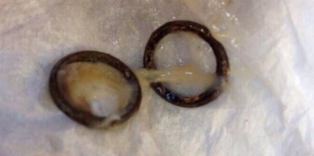 These rusty rings in a McDonald's Happy Meal cheeseburger almost choked 2-year-old Isabella Dally, her mother Miceala alleges.