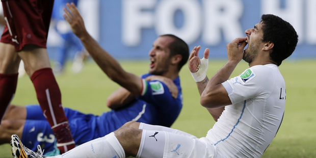 Uruguay's Luis Suarez holds his teeth after biting Italy's Giorgio Chiellini's shoulder.
Photo / AP