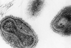 1975 file electronmicrograph from the CDC shows the smallpox virus. Photo / AP