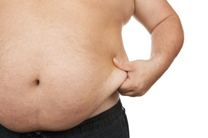 Could food capsules work better than weight loss surgery to combat obesity? Photo / Thinkstock