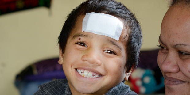 Rawiri Te Whata was hit by a car outside his Welcome Bay home, he has defied the odds and bounced back and is now at home.