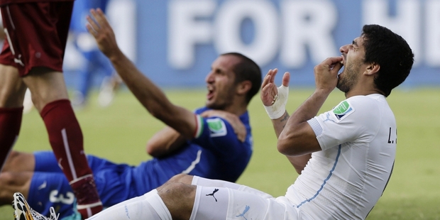 Uruguay's Luis Suarez holds his teeth after biting Italy's Giorgio Chiellini. Photo / AP