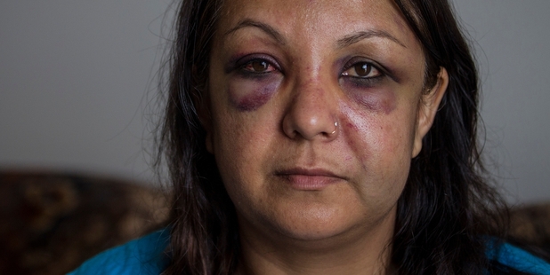 Praveet Singh was assaulted walking in Papatoetoe and is outraged that people ignored her cries.MICHAEL CRAIG