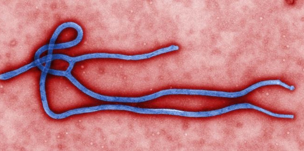 An image from the Centres for Disease Control and Prevention shows an Ebola virus. Photo / AP