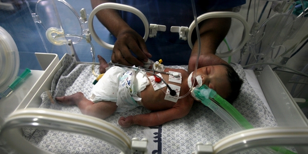 A doctor treats a 3-day-old Palestinian baby in Khan Younis. She was delivered prematurely after her 24-year-old mother was killed by a missile strike.