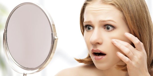 Adult acne is very common and usually affects women in their 20s, 30s and 40s. Photo / Thinkstock